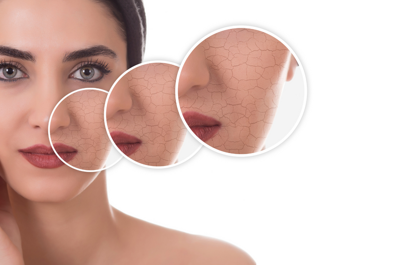 Simple Ways to Treat Dry, Flaky Skin on Face