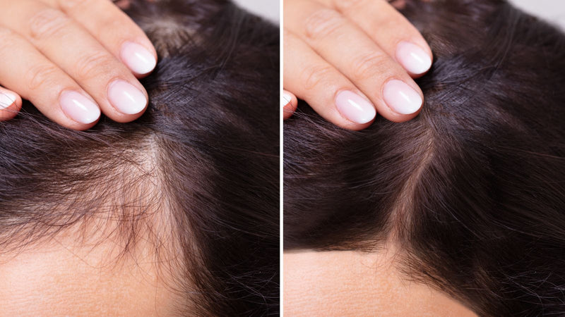 before and after msm powder for hair loss on hair line